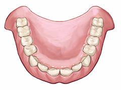 部分入れ歯